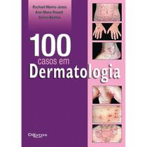 Livro 100 Casos Em Dermatologia - Di Livros