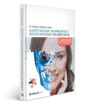 Livro Ajuste Oclusal Em Implantes E Dentes Naturais: Oclusão Em 3d - Napoleão