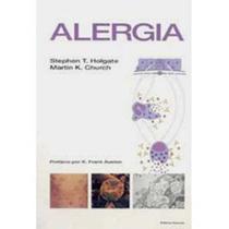 Livro - Alergia