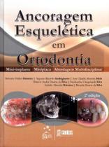 Livro - Ancoragem Esquelética em Ortodontia - Mini-implante - Miniplaca - Abordagem Multidisciplinar
