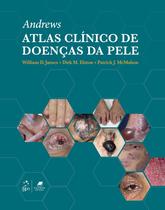 Livro - Andrews Atlas Clínico de Doenças da Pele