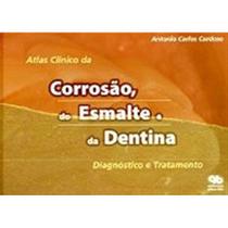 Livro Atlas Clinico Da Corrosao Do Esmalte E Da Dentina - Santos Publicações