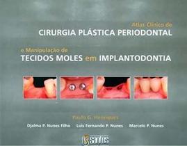 Livro - Atlas Clínico de Cirurgia Plástica Periodontal