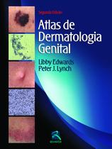 Livro - Atlas de Dermatologia Genital