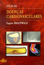 Livro - Atlas de Doenças Cardiovasculares