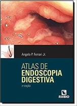 Livro - Atlas de Endoscopia Digestiva - Ferrari Jr. - Rúbio