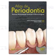 Livro - Atlas de Periodontia - Moraes - Quintessence