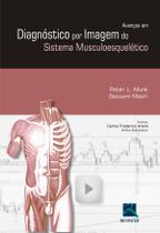 Livro - Avanços em Diagnósticos por Imagem do Sistema Musculoesquelético