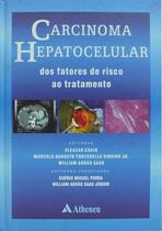 Livro - Carcinoma hepatocelular - dos fatores de risco ao tratamento