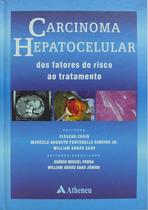 Livro - Carcinoma hepatocelular - dos fatores de risco ao tratamento