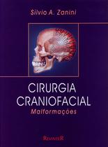 Livro - Cirurgia Craniofacial