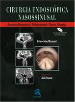 Livro - Cirurgia Endoscopica Nasossinusal