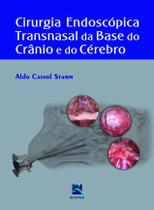 Livro - Cirurgia Endoscópica Transnasal da Base do Crânio