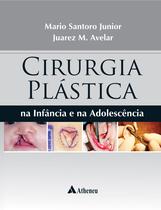 Livro - Cirurgia plástica na infância e na adolescência Livro - Cirurgia plástica na infância e na adolescência