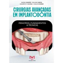 Livro Cirurgias Avançadas Em Implantodontia Princípios, Fundamentos e Técnicas Livro Cirurgias Avançadas Em Implantodontia Princípios, Fundamentos e Técnicas