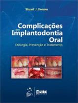 Livro - Complicações em Implantodontia Oral - Etiologia, Prevenção e Tratamento Livro - Complicações em Implantodontia Oral - Etiologia, Prevenção e Tratamento