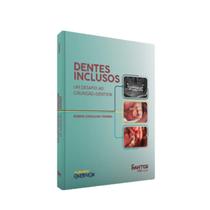 Livro Dentes Inclusos Um Desafio ao Cirurgião Dentista, 1ª Edição - Santos Publicações