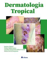Livro - Dermatologia Tropical