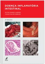 Livro - Doença inflamatória intestinal