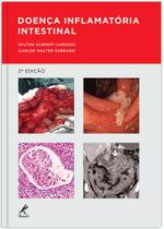 Livro - Doença inflamatória intestinal Livro - Doença inflamatória intestinal