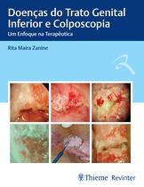 Livro - Doenças do Trato Genital Inferior e Colposcopia