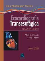Livro - Ecocardiografia Transesofágica