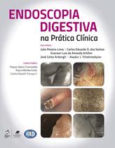 Livro - Endoscopia Digestiva na Prática Clínica