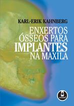 Livro - Enxertos Ósseos para Implantes na Maxila