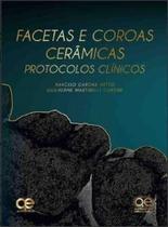 Livro Facetas E Coroas Cerâmicas Protocolos Clínicos - Quintessence