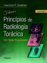 Livro Felson Principios De Radiologia Toracica - Di Livros