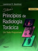 Livro Felson Principios De Radiologia Toracica - Di Livros