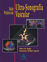 Livro - Guia Prático de Ultrassonografia Vascular