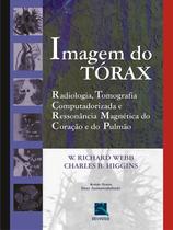 Livro - Imagem do Tórax