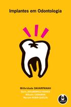 Livro - Implantes em Odontologia