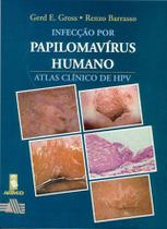 Livro - Infecção por Papilomavírus Humano