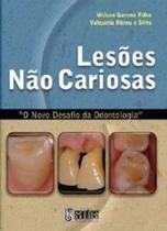 Livro: Lesões Não Cariosas - O Novo Desafio Da Odontologia - Wilson Garone Filho E Valquíria Abreu