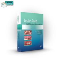Livro Lesões Orais na Infância e Adolescência - Imparato - Santos Pub - Santos Publishing