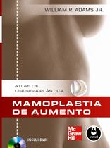 Livro - Mamoplastia de Aumento