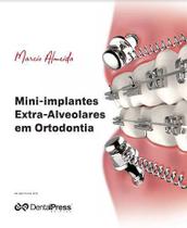 Livro Mini-Implantes Extra-Alveolares Em Ortodontia - dental press