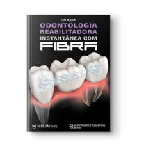 Livro Odontologia Reabilitadora Instantânea Com Fibra - Napoleão Livro Odontologia Reabilitadora Instantânea Com Fibra - Napoleão