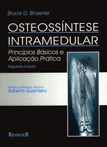 Livro - Osteossíntese Intramedular Livro - Osteossíntese Intramedular