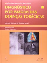 Livro - Radiologia e Diagnóstico por Imagem - Diagnóstico por Imagem das Doenças Torácicas