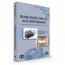 Livro - Reabilitação Oral de Alta Performance: Planejamento Reverso sobre Dentes e Implantes - Greco - Quintessence