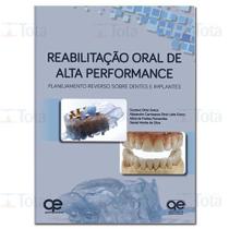 Livro - Reabilitação Oral de Alta Performance: Planejamento Reverso sobre Dentes e Implantes - Greco - Quintessence