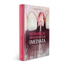 Livro Restauração Dentoalveolar Imediata Implantes Com Provisionalização Imediata Em Alvéolos Comprometidos, 2ª Edição 2023