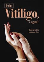 Livro - Tenho vitiligo, e agora?