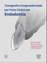Livro - Tomografia Computadorizada por Feixe Cônico em Endodontia - Patel - Quintessence