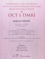Livro - Tomografia em Coerência Óptica e Degeneração Macular Relacionada à Idade Livro - Tomografia em Coerência Óptica e Degeneração Macular Relacionada à Idade