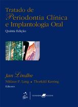 Livro - Tratado de Periodontia Clínica e Implantologia Oral