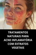Livro Tratamentos Naturais Para Acne Inflamatória Com Extratos Vegetais